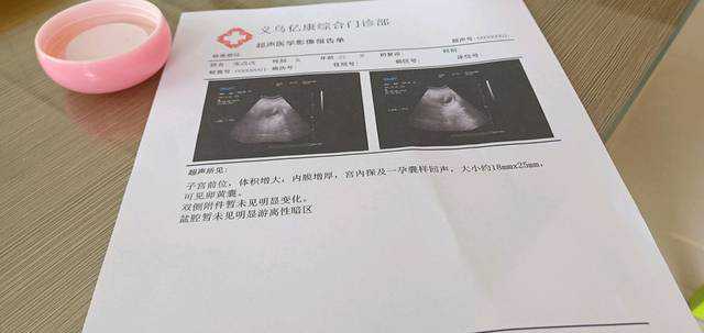 广州代孕好吗-广州代孕是否要求血型？